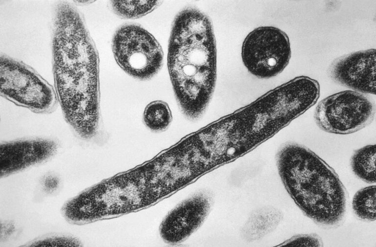 Focolaio di legionella nel milanese